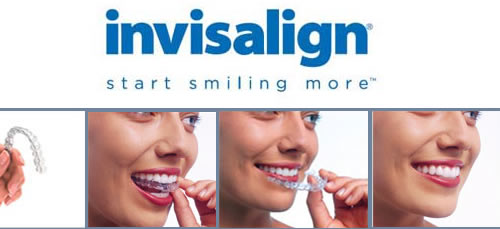 Invisalign